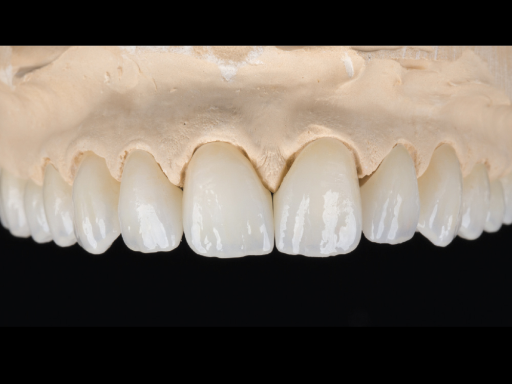 Supporting Long-Term Soft-Tissue Health: Figure 8