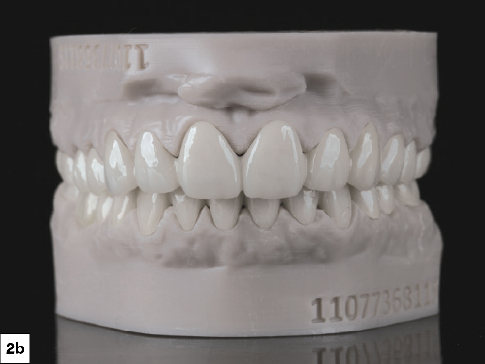 Supporting Long-Term Soft-Tissue Health: Figure 2b