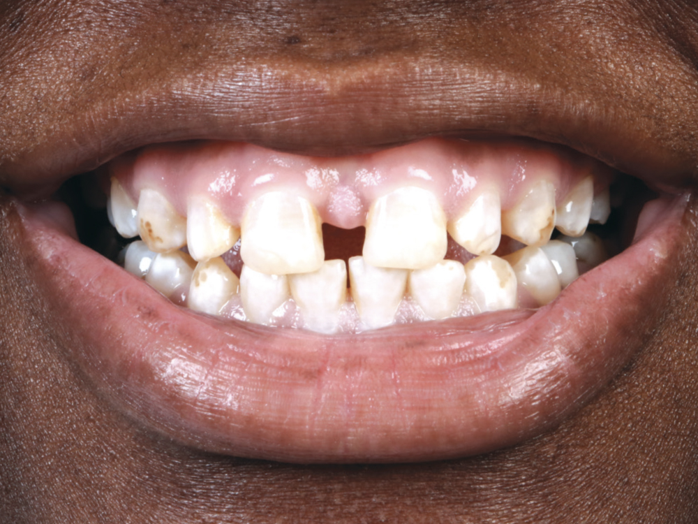 Supporting Long-Term Soft-Tissue Health: Figure 1