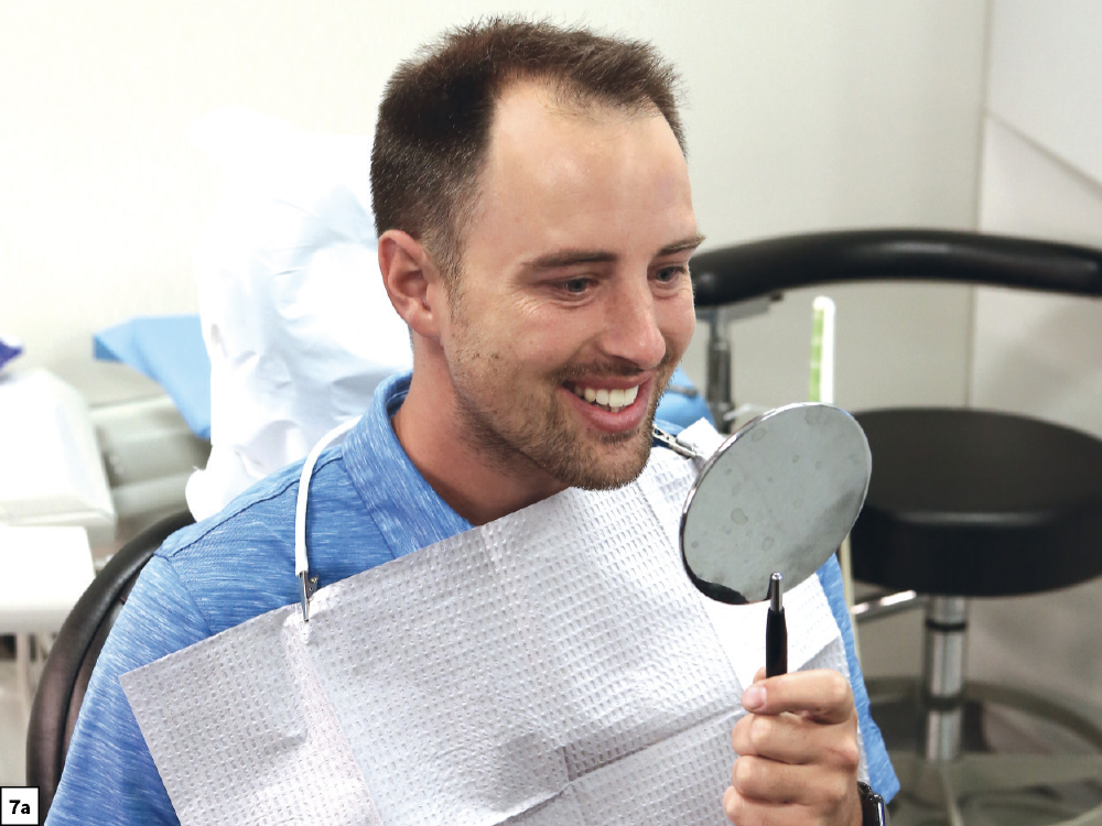 Figure 7a - Using a Diagnostic Wax-Up to Achieve Optimal Esthetics