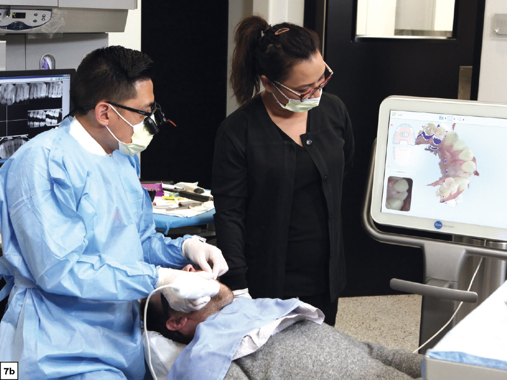 Figure 7b - Using a Diagnostic Wax-Up to Achieve Optimal Esthetics