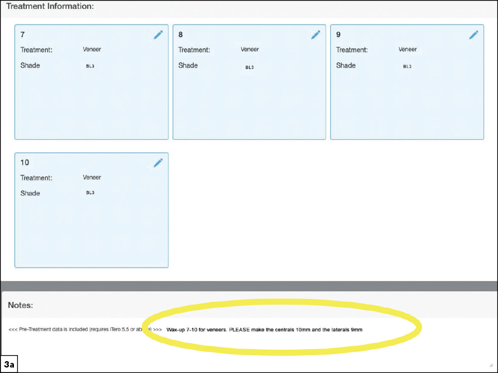 Figure 3a - Using a Diagnostic Wax-Up to Achieve Optimal Esthetics