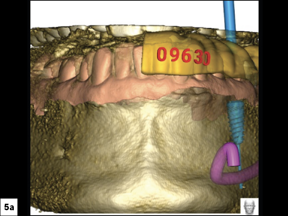 CBCT Scan (Front View)