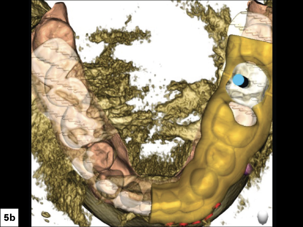 CBCT Scan (Top View)