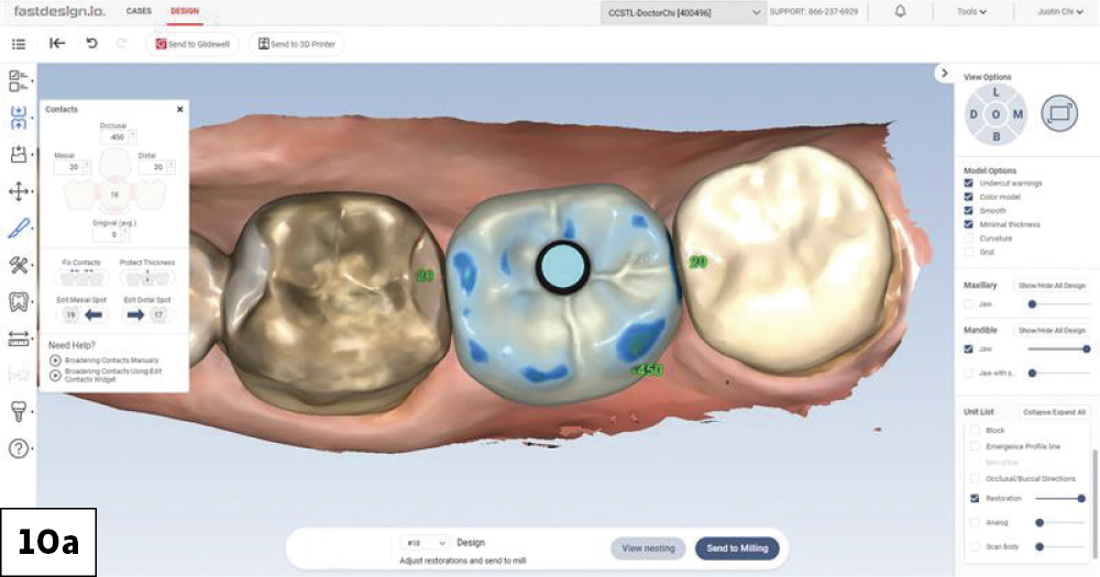 fastscan.io implant scan (top view)