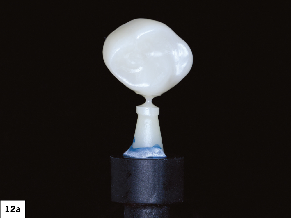 The fastmill.io milled a beautiful and translucent BruxZir Esthetic NOW Posterior crown-2