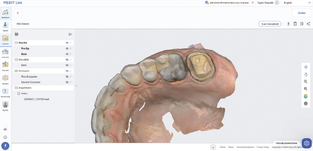 The final scan shows well-exposed margins