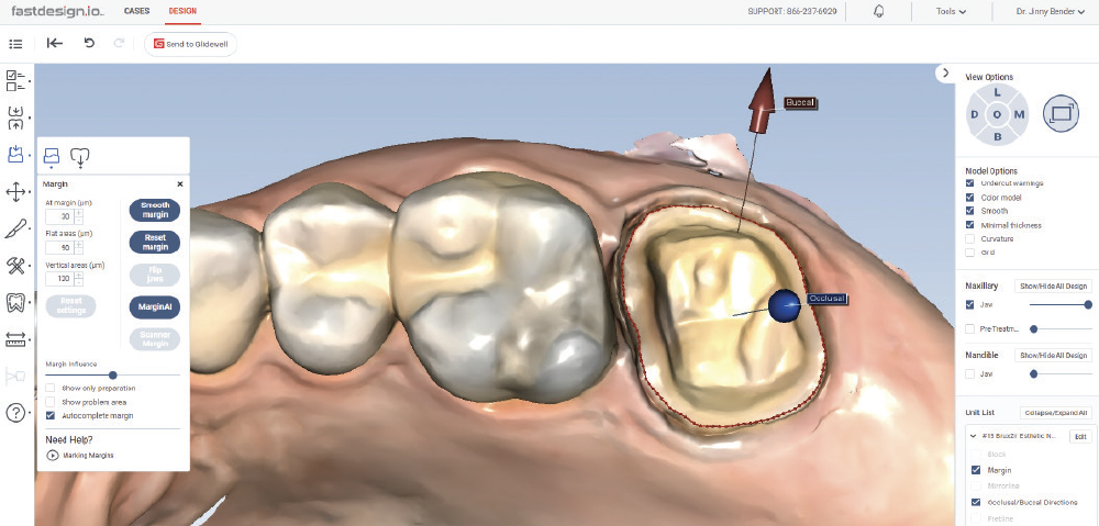MarginAI™ software, which is part of the fastdesign.io software suite, detected most of the margin