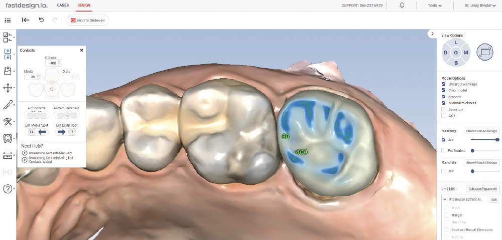 CrownAI™ generated a design to fit the space