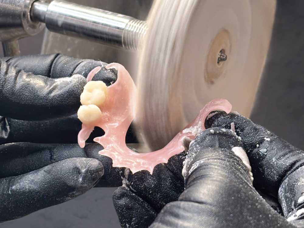 Polishing Flexible Partial Dentures