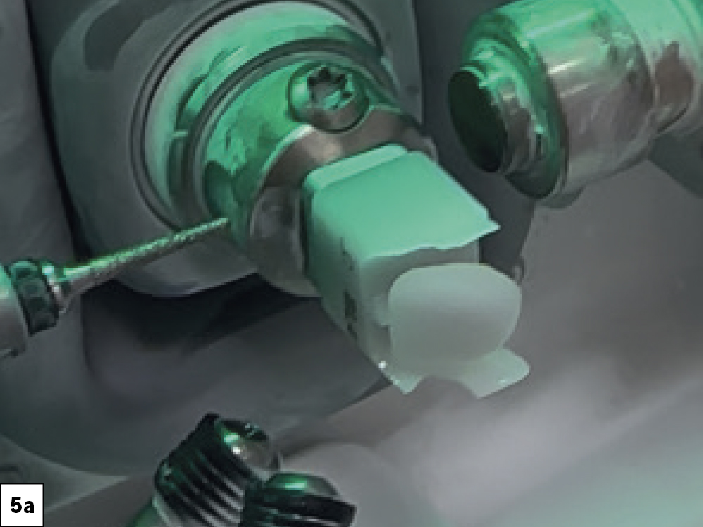 Each restoration took about 15 minutes to mill