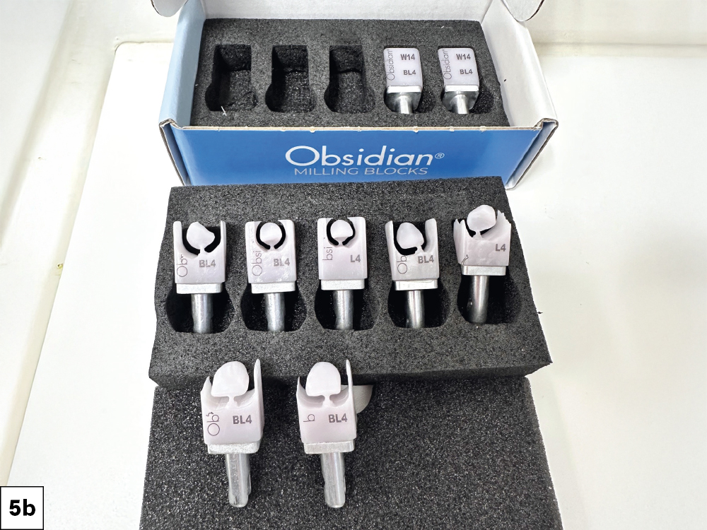 selected the bleach shade BL4, which is comparable to a VITA 3D-Master® OM1 shade