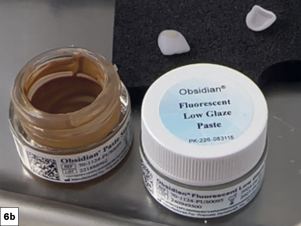 on the gingival third to replicate natural cervical saturation and MiYO Lumin to the remaining two-thirds to establish the primary chroma and value