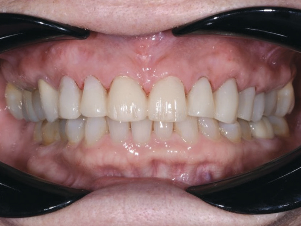 Although the initial plan was for same-day delivery, Tamara decided to return the next day