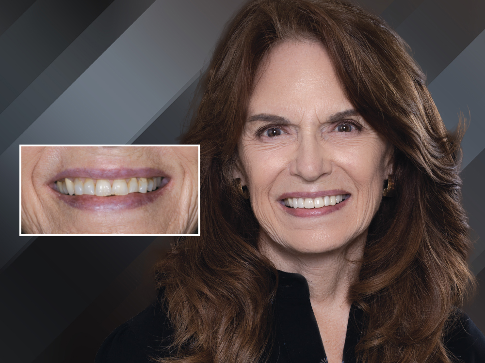 Tamara’s rejuvenated smile demonstrated the power of clinical artistry and digital efficiency