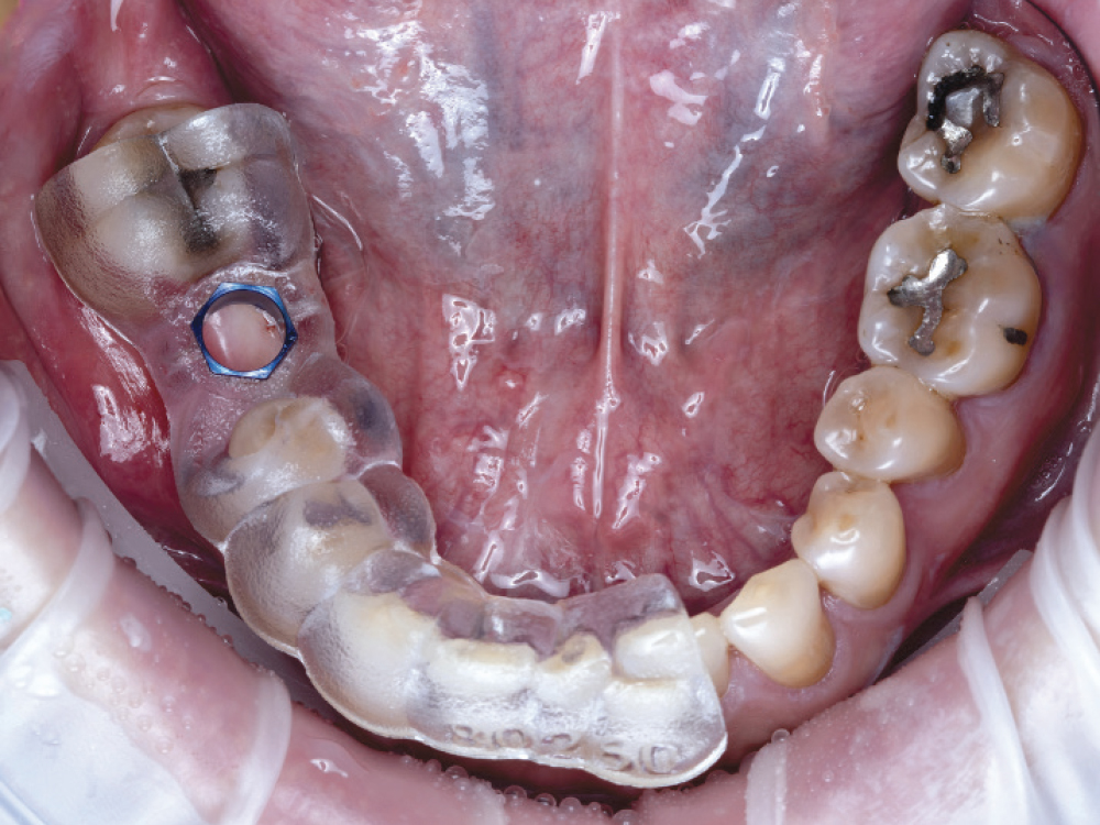 Applied Surgical Guide to Mouth