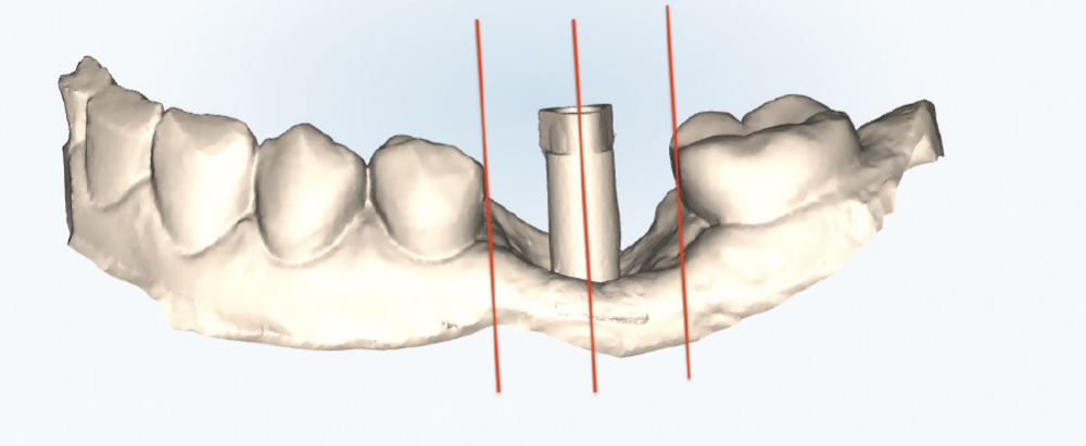Verify the Path of Draw