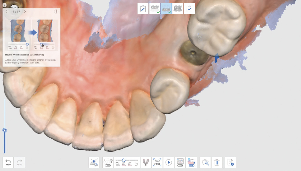 Capture Adjacent Contacts Strategically