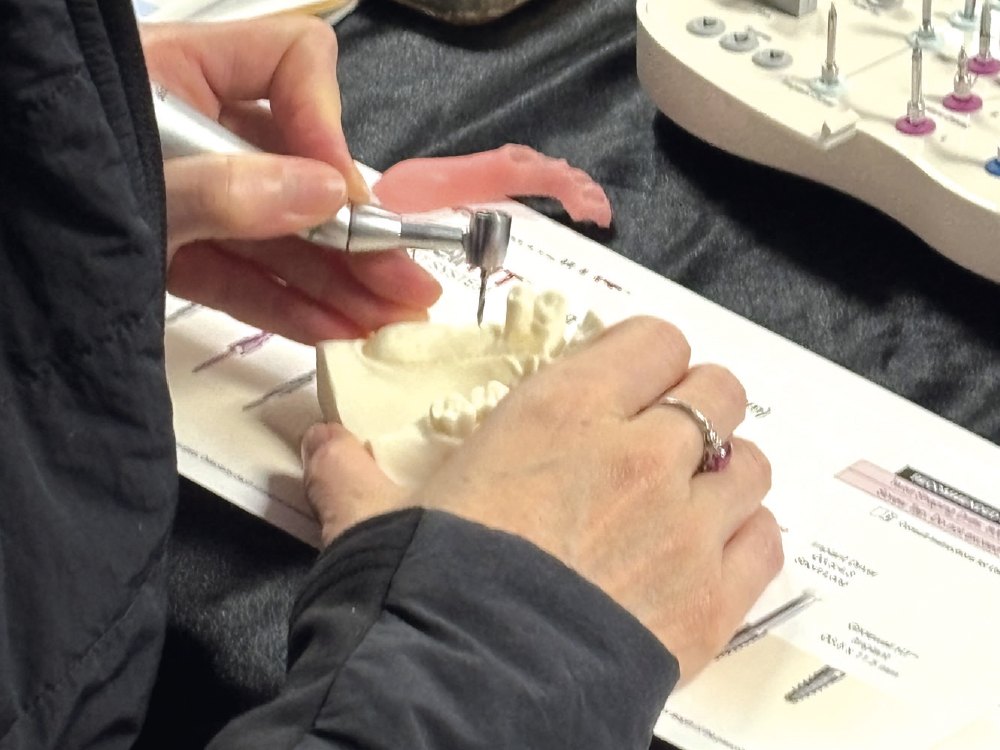 The hands-on section will allow participants to utilize a model to practice using a surgical kit, placing two implants, and learning grafting and suturing techniques