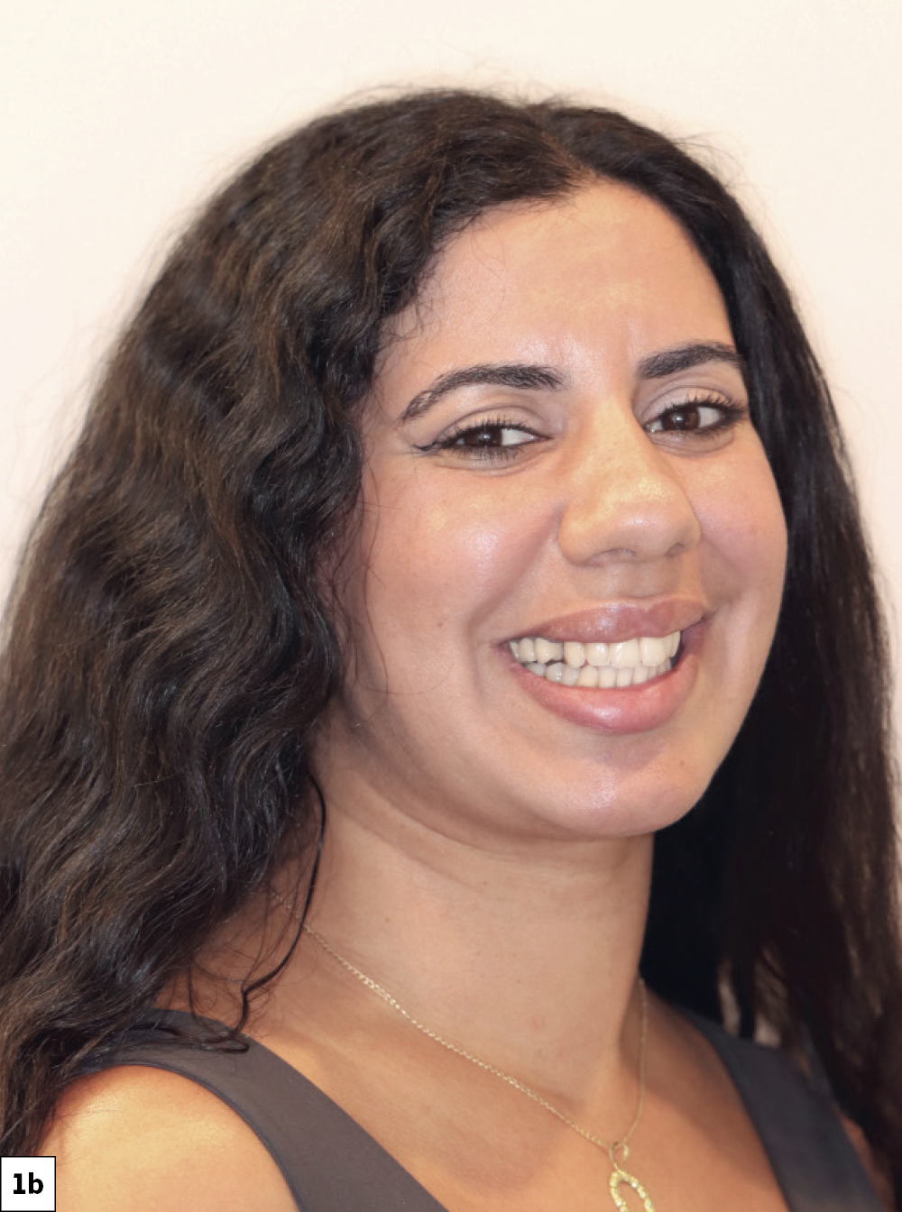 She entered the office that morning missing two premolars and left a few hours later with final, monolithic zirconia restorations that were both functional and esthetically pleasing-b