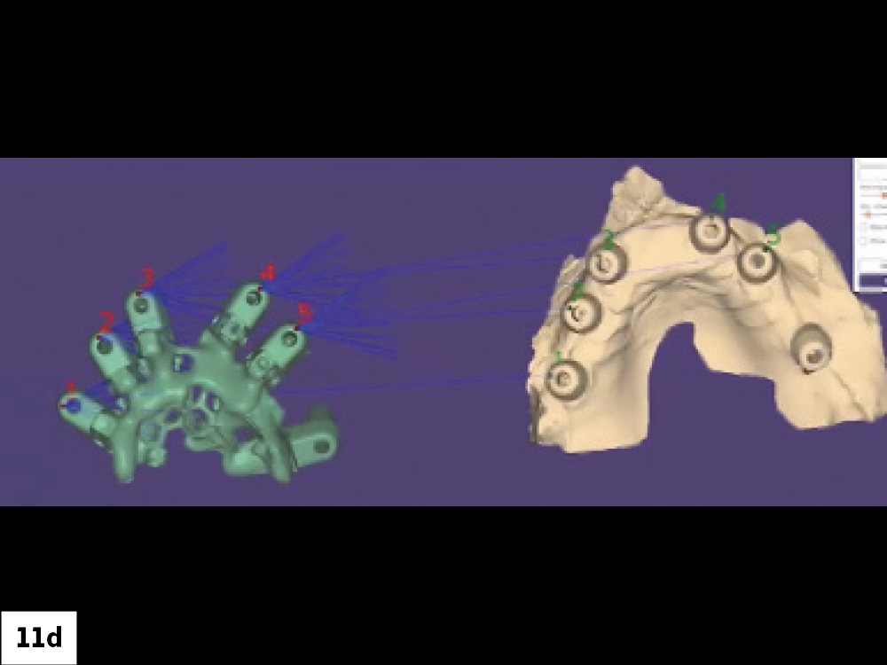 Aligning Teeth to Soft Tissue