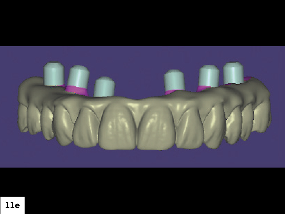 Completed Digital Design