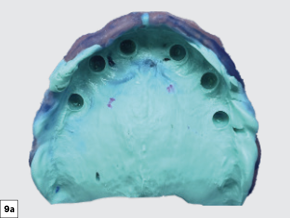 VPS Impression Denture Reline