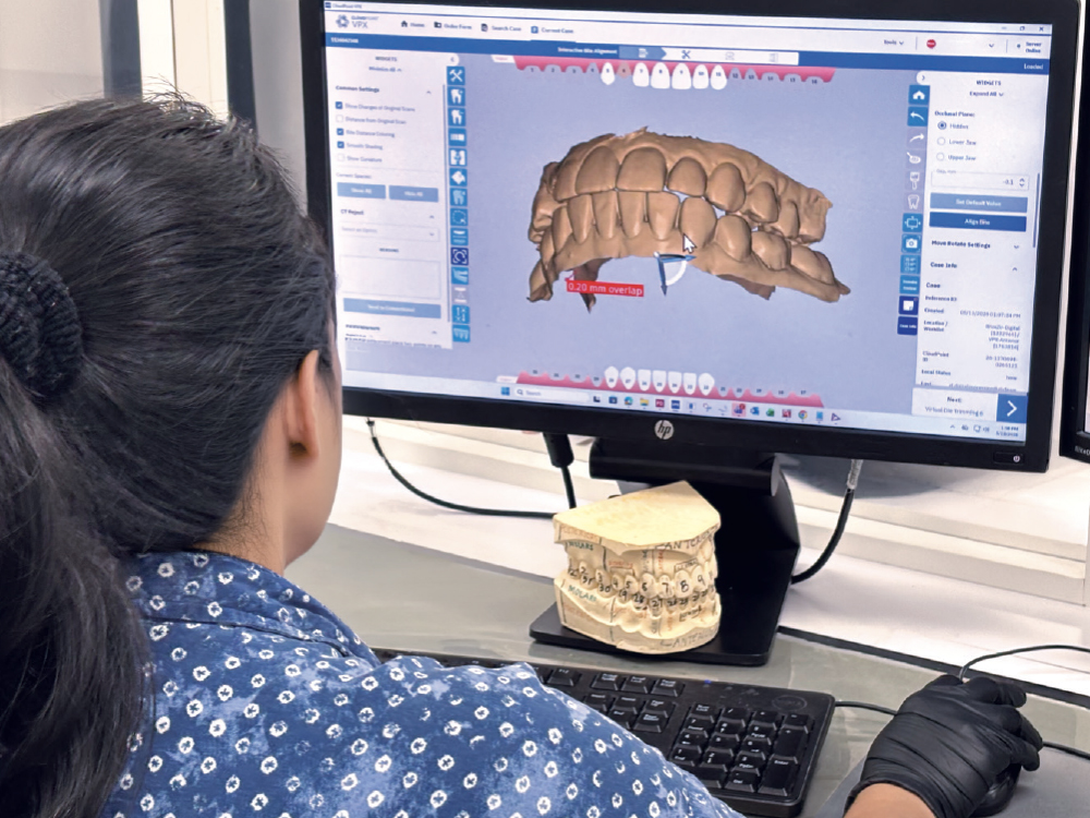 Dental tech using design software