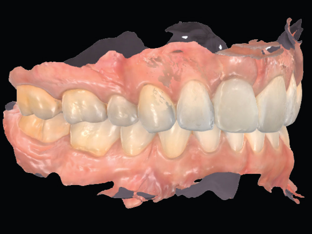The patient returned after three months for re-evaluation and final records.