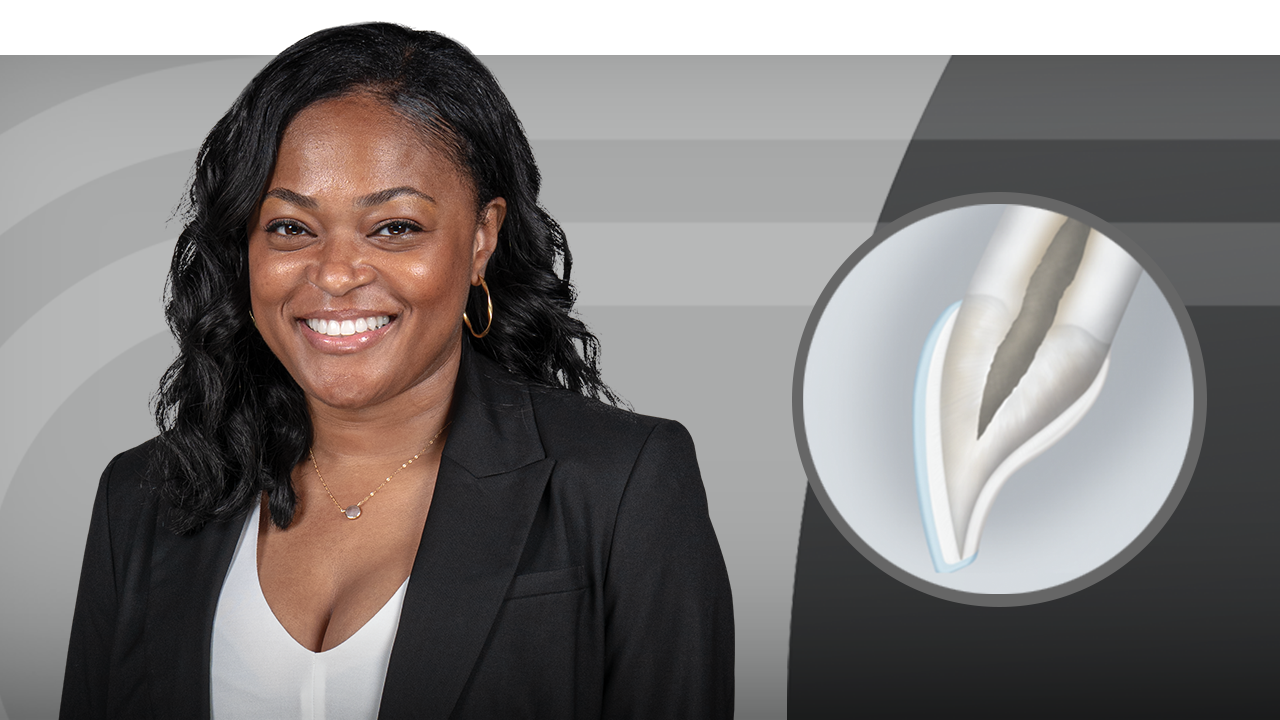 Esthetic Veneer Preparations: From No Prep to Full Prep 