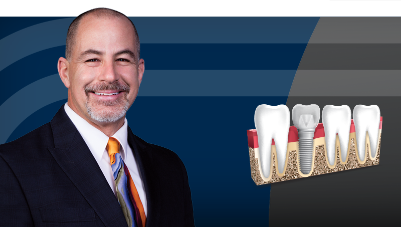 Implant Treatment Planning: The Contributing Factors