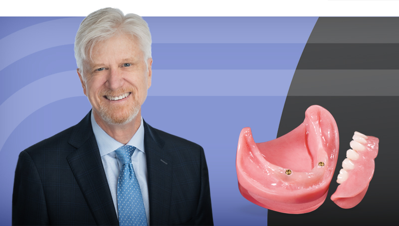 Restoration of Implant Overdentures