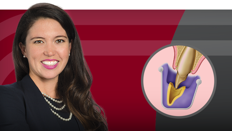 Restoring Implants: Tissue Preparation and Impression Techniques Hero Image