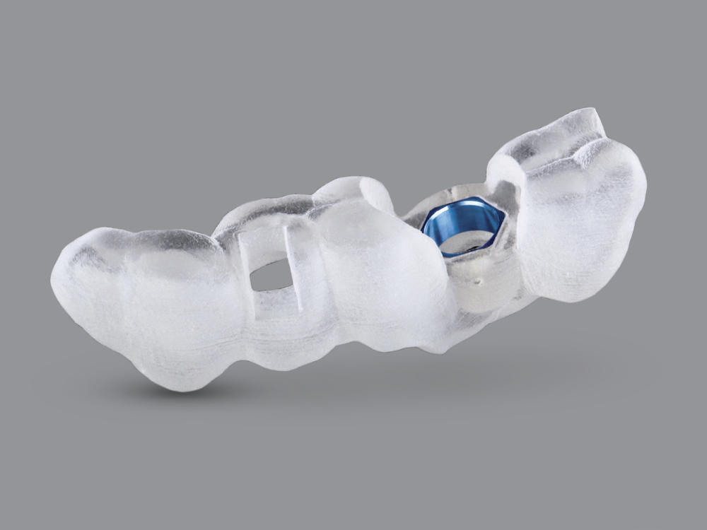 Glidewell’s Digital Treatment Planning (DTP)