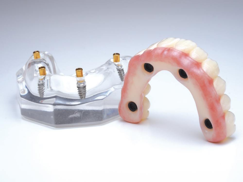 The prosthesis features a convex intaglio design.