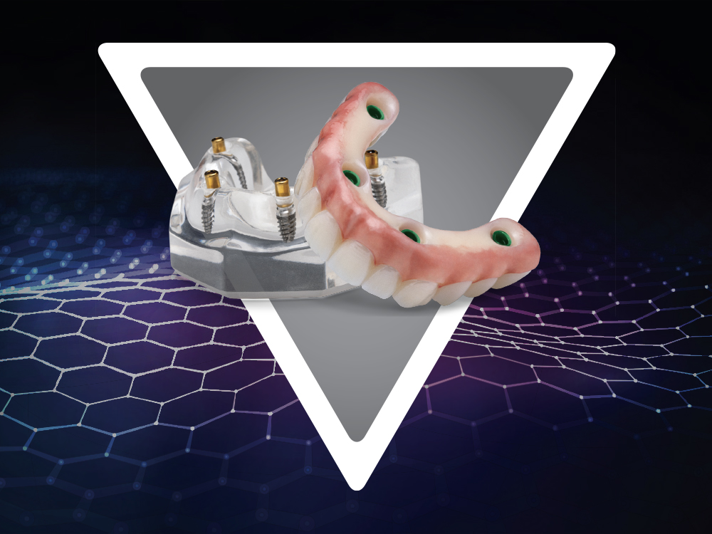 Product Spotlight: Locator® Fixed Prosthesis