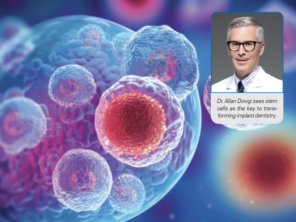 Unlocking Stem Cell Technology for Implant Dentistry
