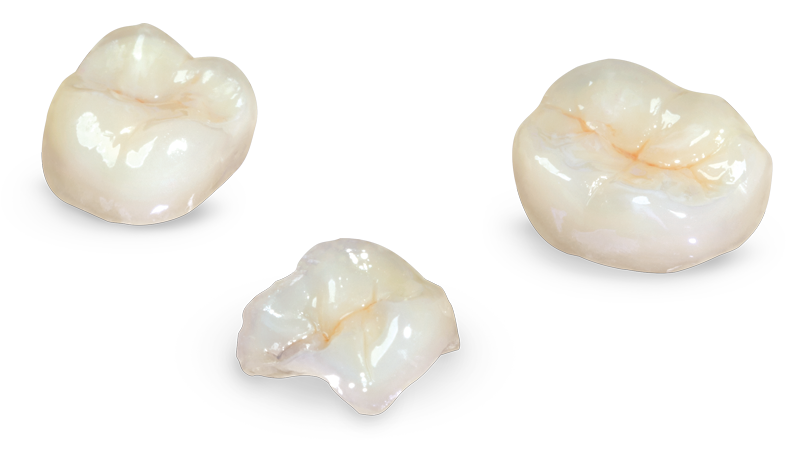 Composite Restorations