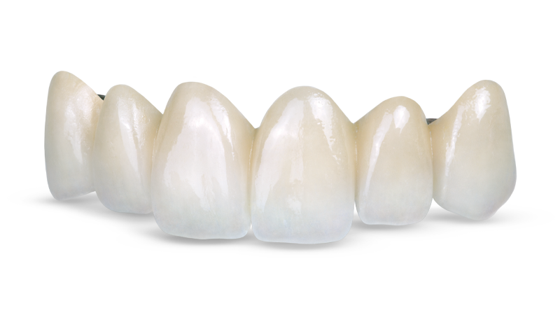 Obsidian Fused to Metal Signature Image