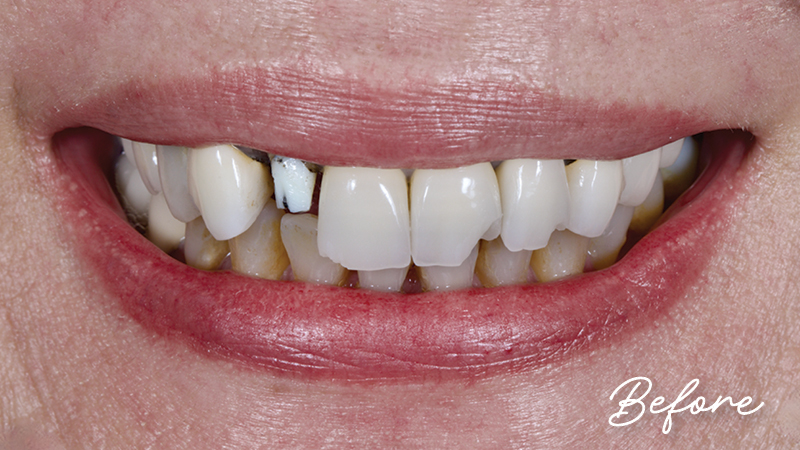 Clinical study- case 1 before