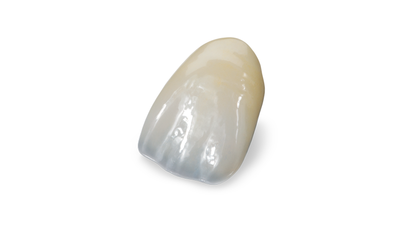 BruxZir Esthetic single unit anterior