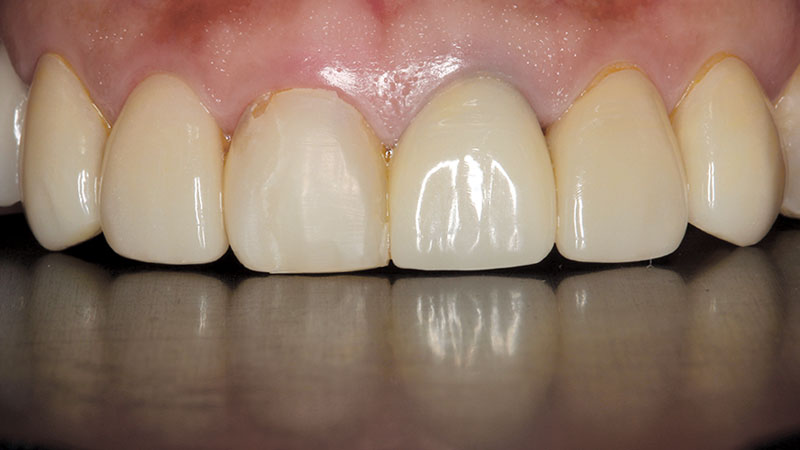Clinical study- case 1 before