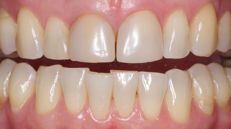 Clinical study- case 2 before