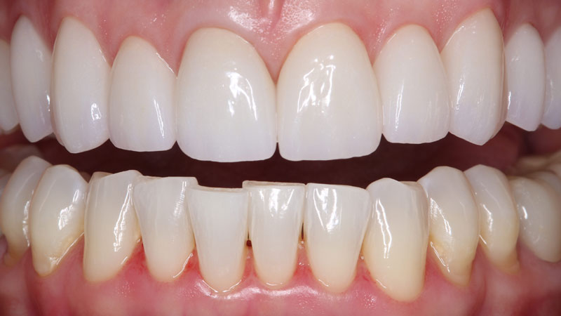 Clinical study- case 2 after