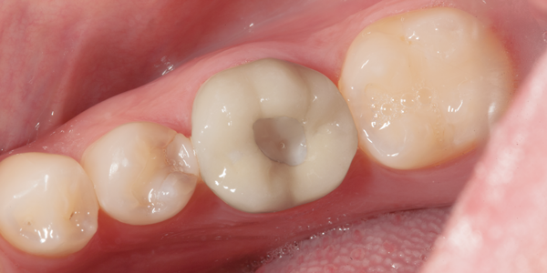 Clinical study- case 6 before