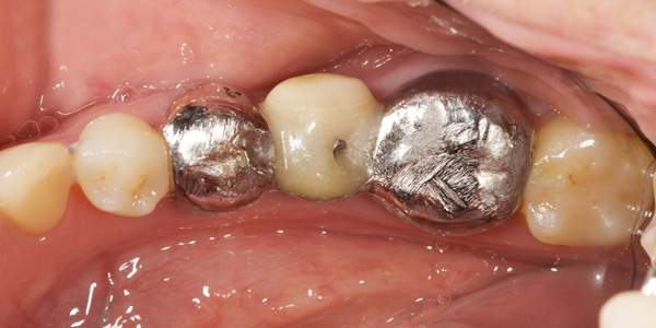Clinical study- case 4 before