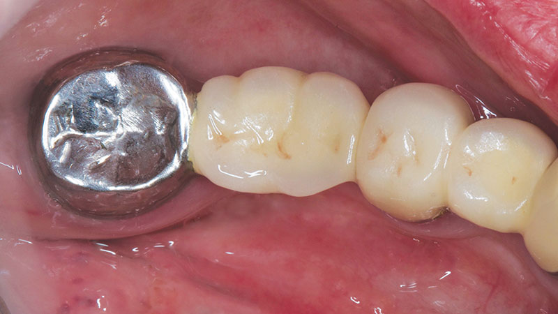 Clinical study- case 1 before