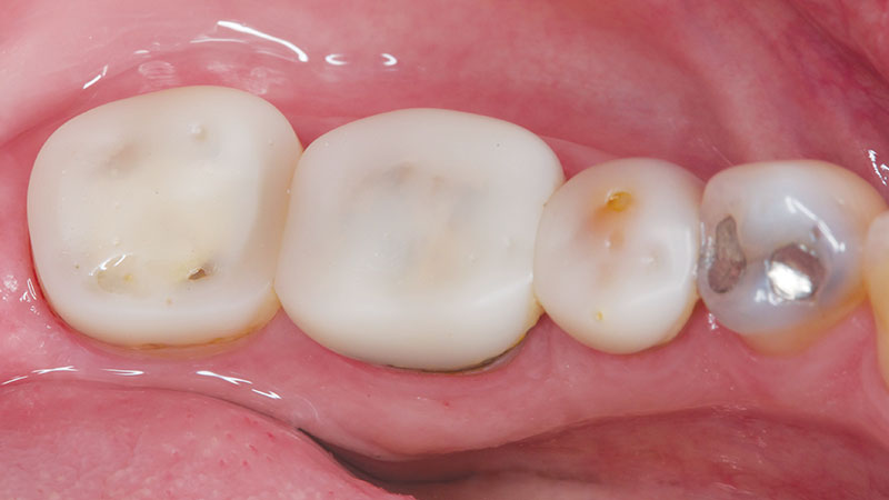 Clinical study- case 3 before