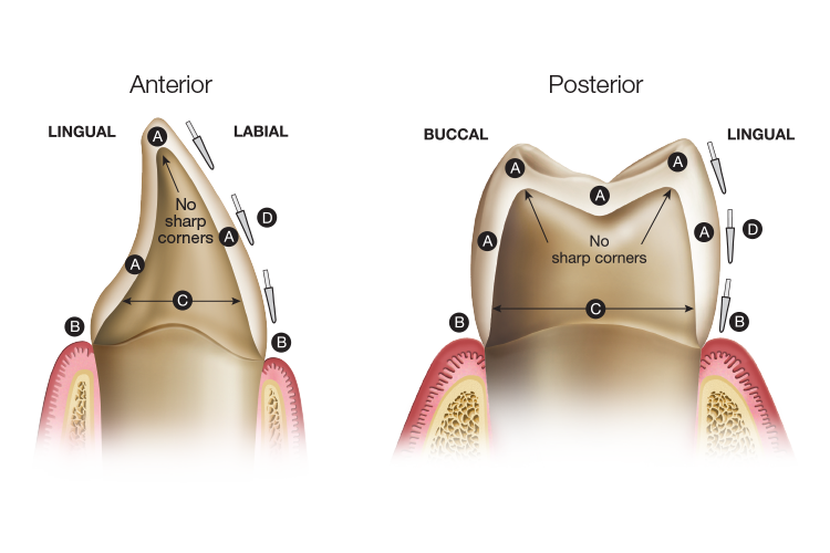 BruxZir 10 year study result