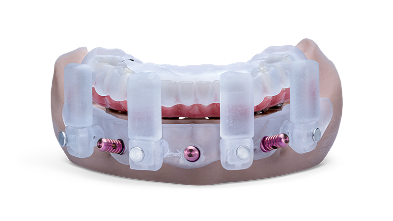 GlidePRO Stackable Surgical Guides